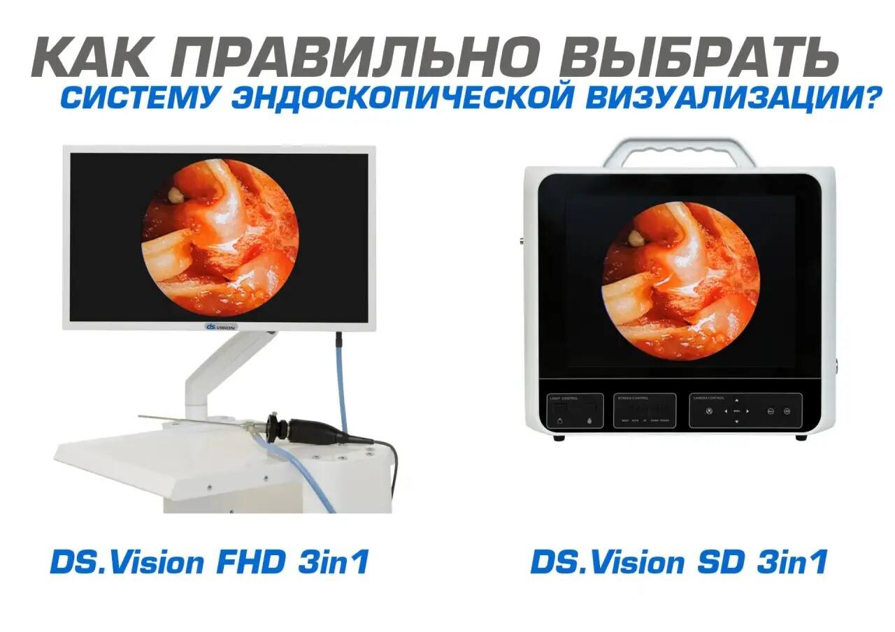 Какую систему эндоскопической визуализации выбрать под свои задачи: DS.Vision SD или FHD?